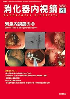 消化器内視鏡33巻5号2021年5月号 消化管悪性リンパ腫のすべて 消化器内視鏡33巻5号2021年5月号 消化管悪性リンパ腫のすべて